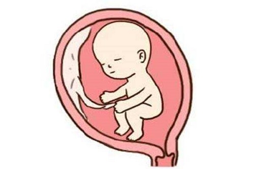 試管嬰兒過程中常見問題有什么？主要有這四大問題！