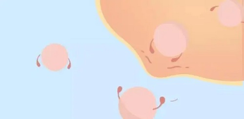 試管嬰兒過(guò)程痛苦嗎？具體過(guò)程是不是很痛苦？