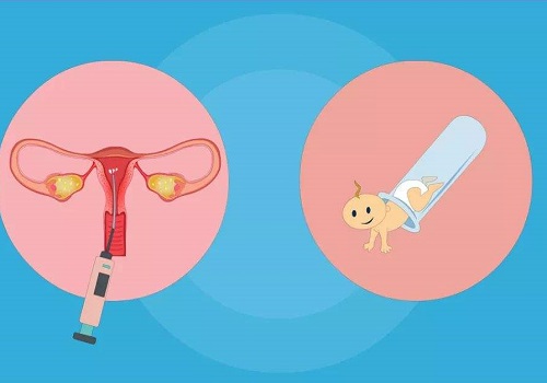 2022合肥試管嬰兒流程指南